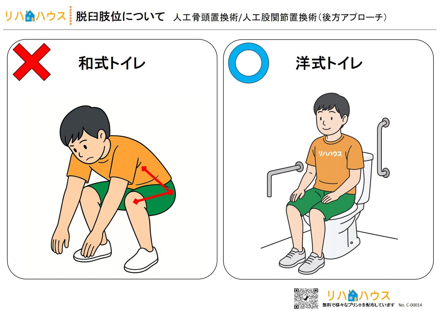  【無料イラスト付き】大腿骨近位部骨折〈後方アプローチ〉術後の脱臼肢位｜トイレ動作におけるリハビリ注意点と指導用プリント – リハビリ/自主 Bildidee 